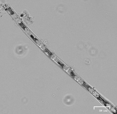 Ulothrix