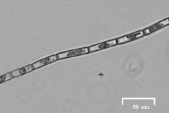 Ulothrix