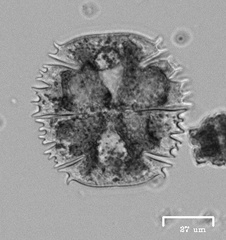 Micrasterias truncata