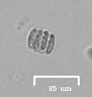 Scenedesmus