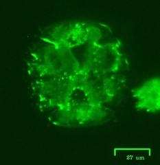 Micrasterias truncata