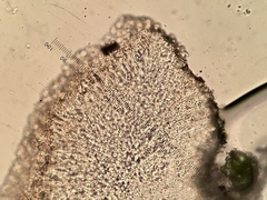 Lecanora symmicta