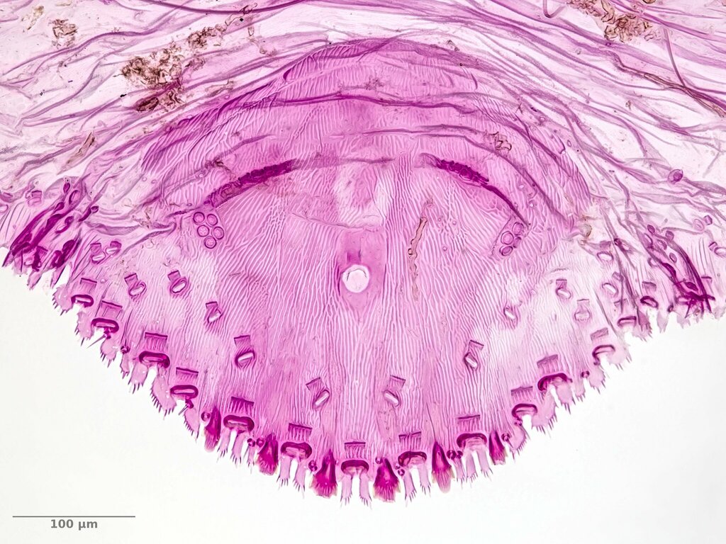 Proteus scale