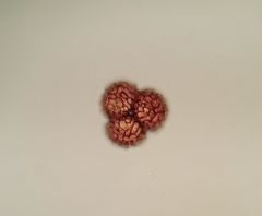 Fossombronia wondraczekii