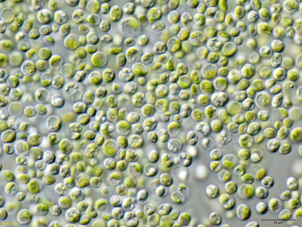 Chlorella vulgaris (Chlorella vulgaris)