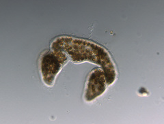 Microcystis wesenbergii
