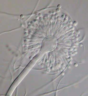 Aspergillus versicolor
