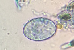 Scutellinia olivascens
