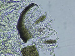 Muellerella lichenicola