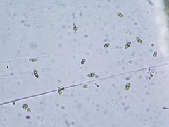 Muellerella lichenicola