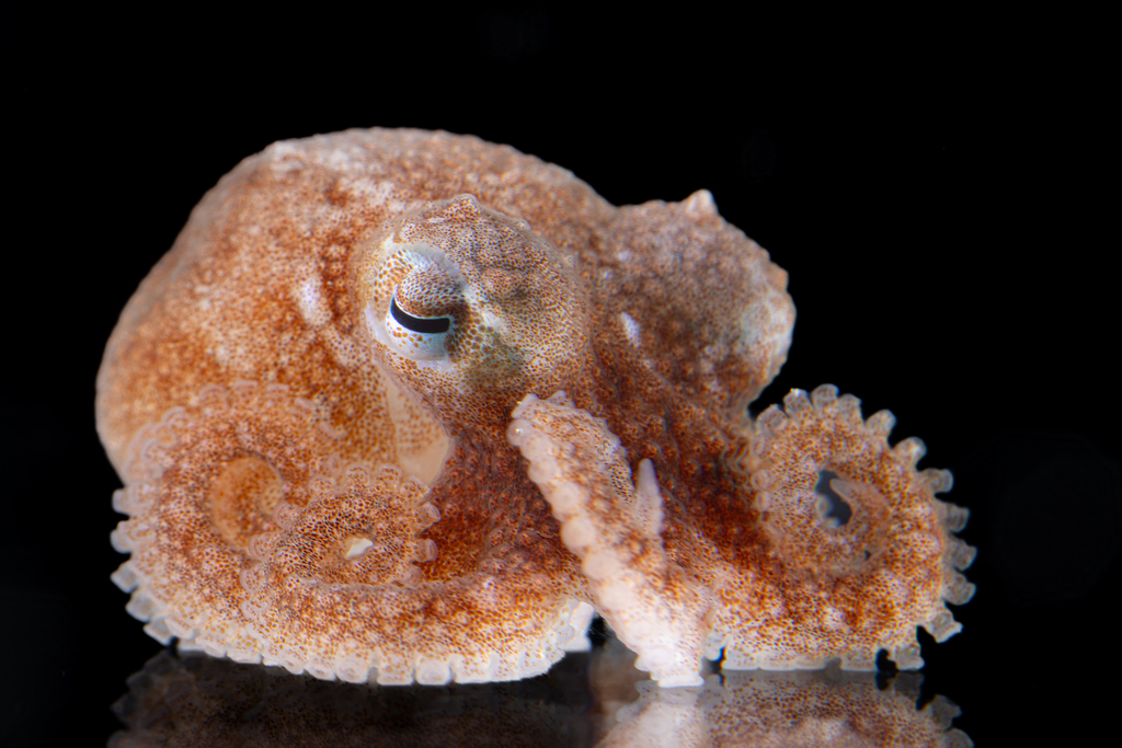 Charcot's Octopus