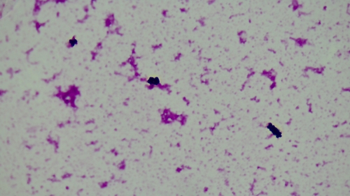 Staphylococcus hominis