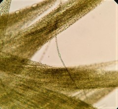 Aphanizomenon flosaquae
