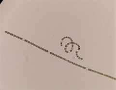 Dolichospermum crassum