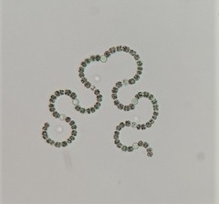 Dolichospermum crassum