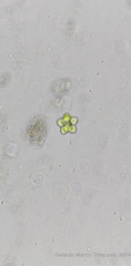Coelastrum