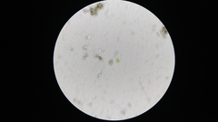 Coelastrum