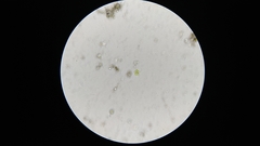 Coelastrum
