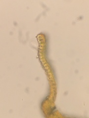 Racomitrium macounii alpinum