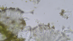 Candelariella xanthostigmoides