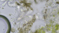 Candelariella xanthostigmoides