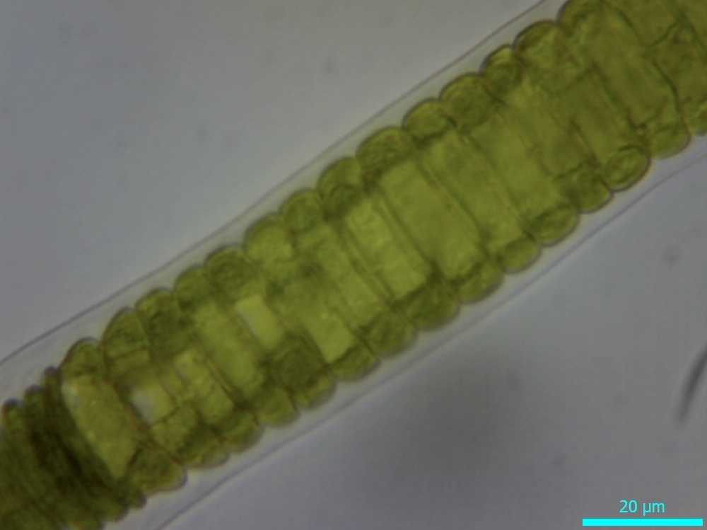 Ulothrix flacca