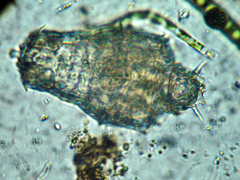 Dissotrocha spinosa