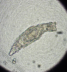 Macrotrachela bilfingeri