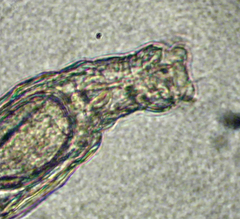 Macrotrachela bilfingeri