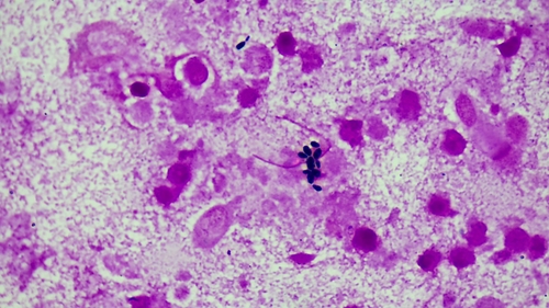 Kluyveromyces