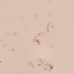 Asterionellopsis glacialis