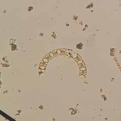 Eucampia zodiacus