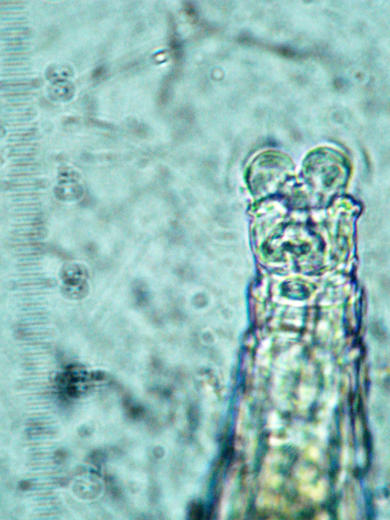 Macrotrachela concinna