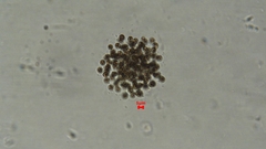 Microcystis