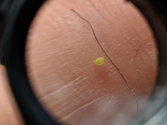 Wolffia brasiliensis