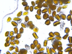 Pucciniastrum epilobii