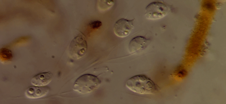 Bicosoeca petiolata