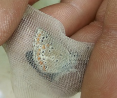 Aricia artaxerxes allous