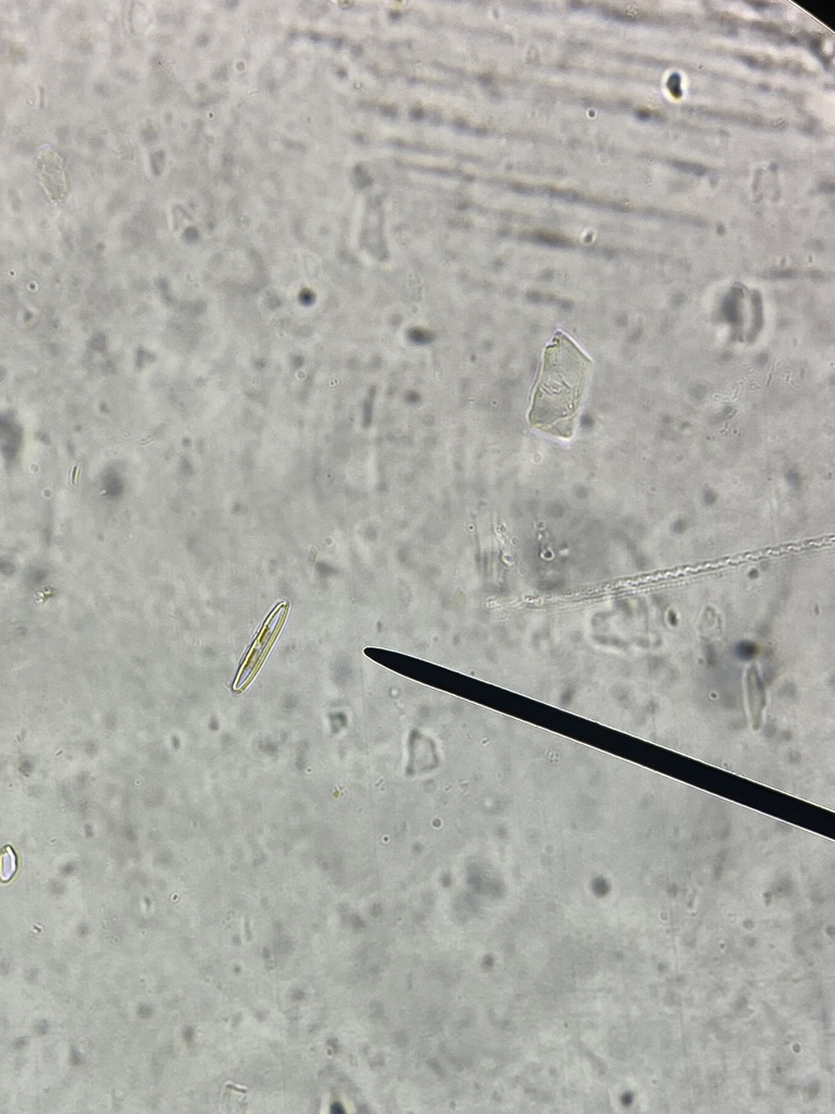 diatoms-from-pasadena-city-college-pasadena-ca-us-on-march-24-2025