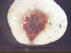 Ceroplastes destructor