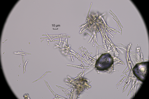 Ramularia triboutiana