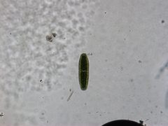 Netrium digitus