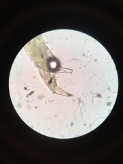 Hesperomyces virescens