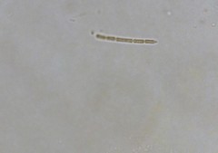 Pseudanabaena