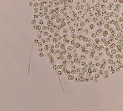 Pseudanabaena