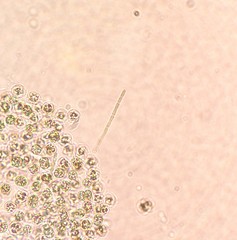 Pseudanabaena