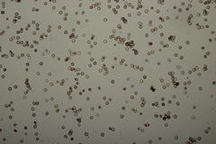 Microbotryum stellariae