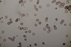 Microbotryum stellariae