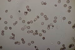 Microbotryum stellariae