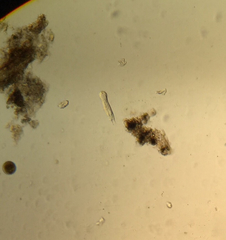 Gastrotricha